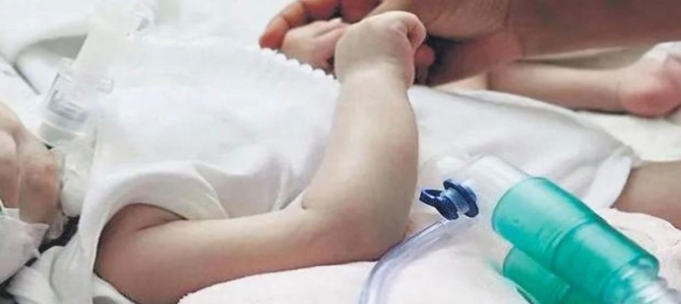 DEVLET SMA TİP 1 HASTALARINA ACİL SAHİP ÇIKMALI