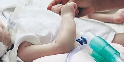 DEVLET SMA TİP 1 HASTALARINA ACİL SAHİP ÇIKMALI